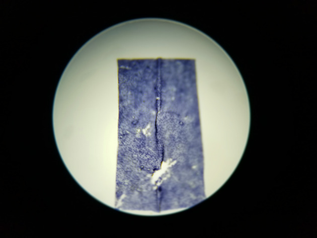 Simple Squamous Epithelium Slides - Simple Squamous Epithelium 02 40X